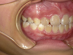 PICT2771s.jpg