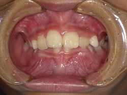 resize00820.jpg