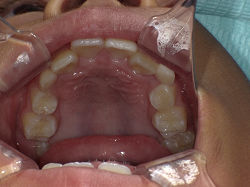 resize00830.jpg