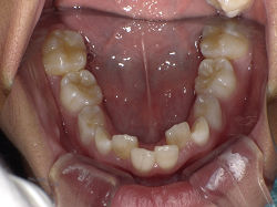 resize00840.jpg