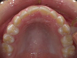 resize0086.jpg