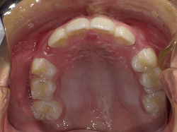 resize00860.jpg