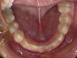 resize0087.jpg