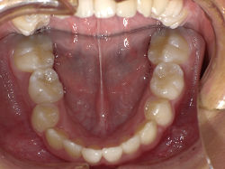 resize00870.jpg