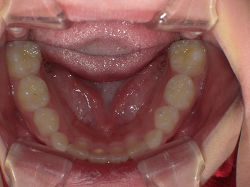 resize0099.jpg